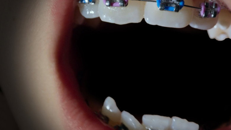 Open Wide still 4